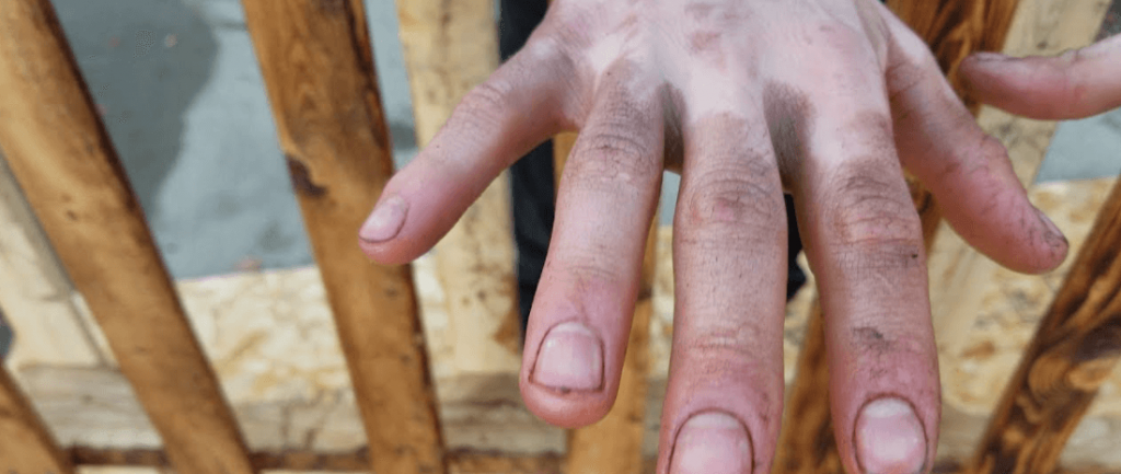 How to get wood Stain off Hands